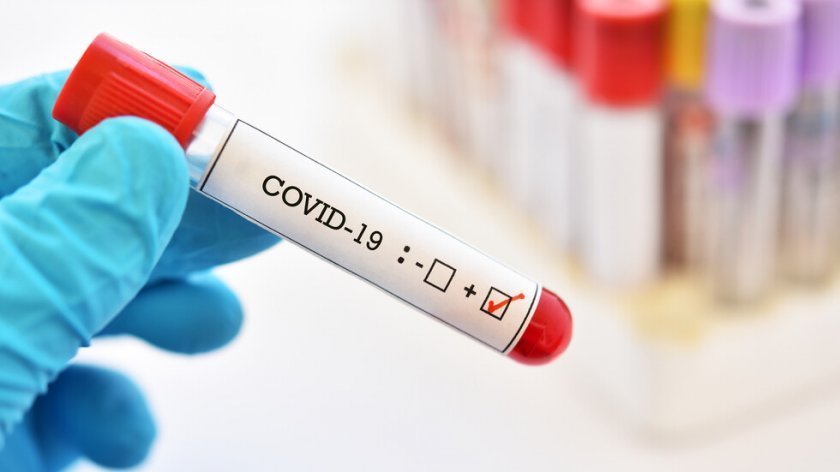 2 180 нови случая на коронавирус