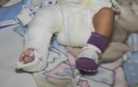 Бебе влиза в болница с жълтеница, излиза със счупен крак